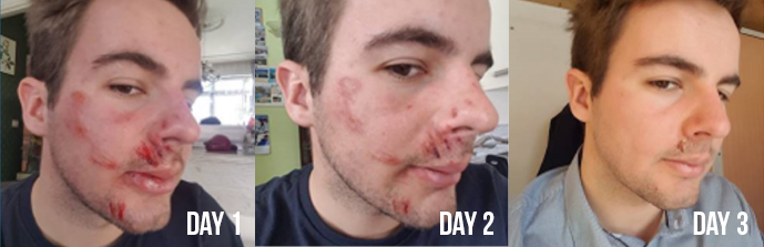 Before and after face
