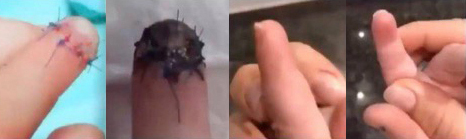 Before and after healing