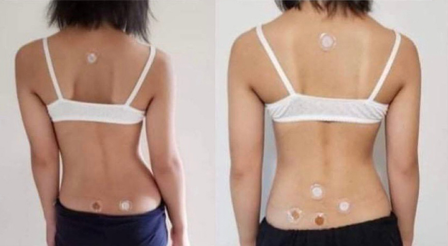 Before and after posture