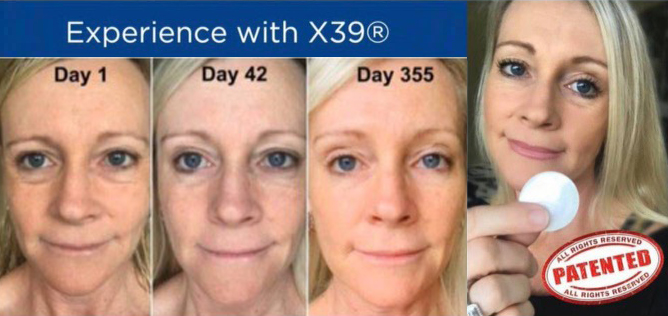 Before and after skin